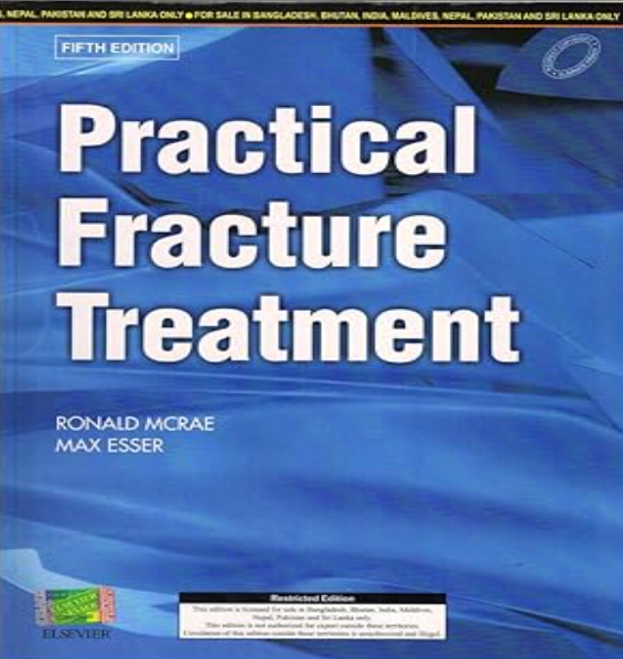 Practical Fracture Treatment, International Edition, 5e